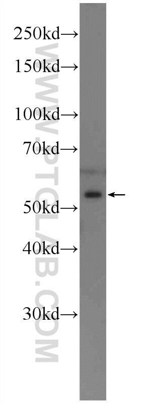 Western Blot (WB) analysis of MCF-7 cells using RARG Polyclonal antibody (11424-1-AP)