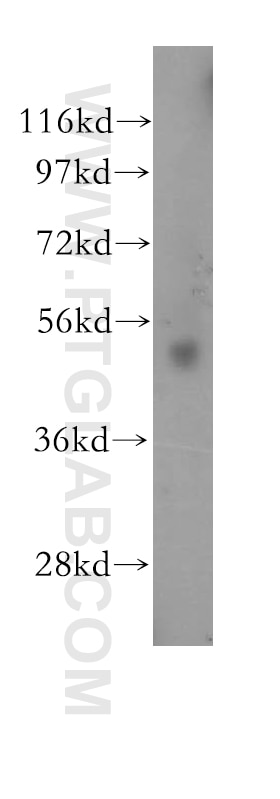Western Blot (WB) analysis of HeLa cells using RARG Polyclonal antibody (11424-1-AP)