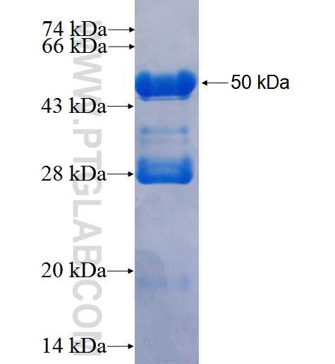RARG fusion protein Ag1991 SDS-PAGE