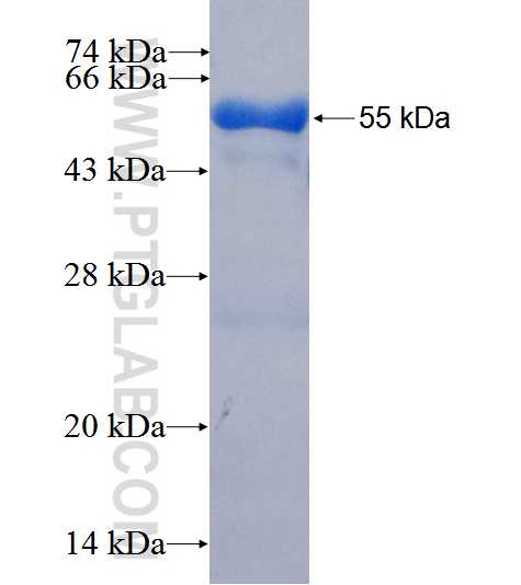 RARRES1 fusion protein Ag26520 SDS-PAGE