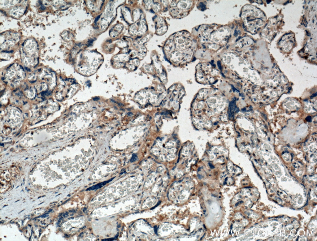 Immunohistochemistry (IHC) staining of human placenta tissue using Chemerin Polyclonal antibody (10216-1-AP)