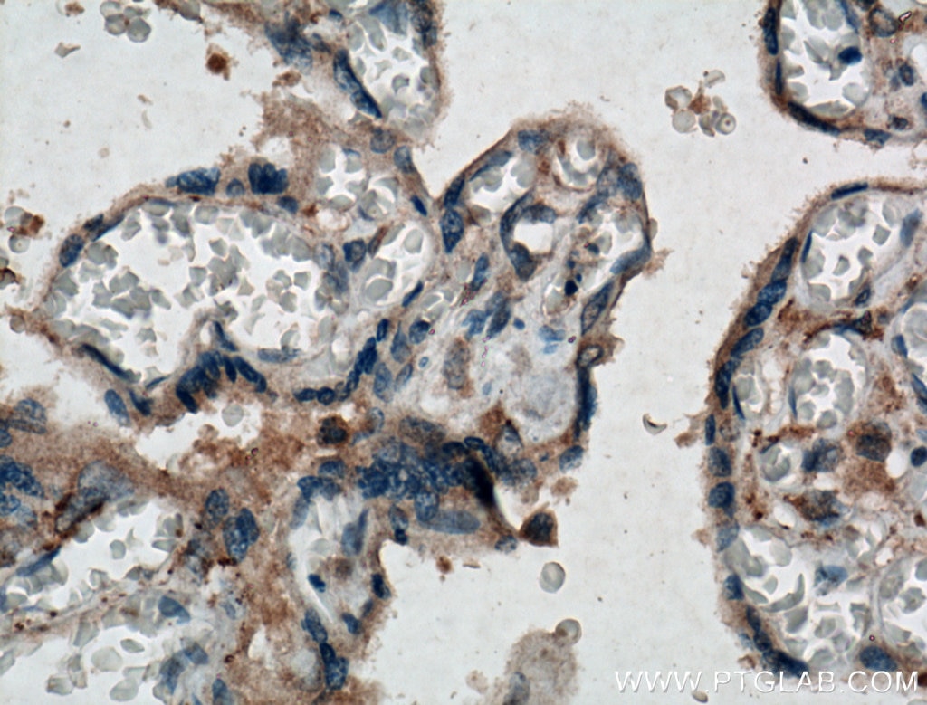 Immunohistochemistry (IHC) staining of human placenta tissue using Chemerin Polyclonal antibody (10216-1-AP)