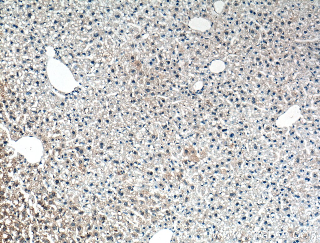 Immunohistochemistry (IHC) staining of mouse liver tissue using Chemerin Polyclonal antibody (10216-1-AP)