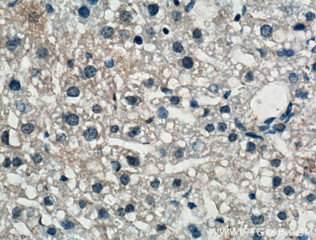 Immunohistochemistry (IHC) staining of mouse liver tissue using Chemerin Polyclonal antibody (10216-1-AP)
