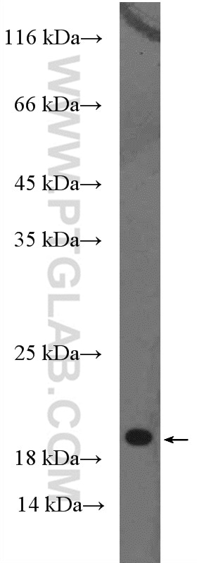 Western Blot (WB) analysis of human plasma using Chemerin Polyclonal antibody (10216-1-AP)