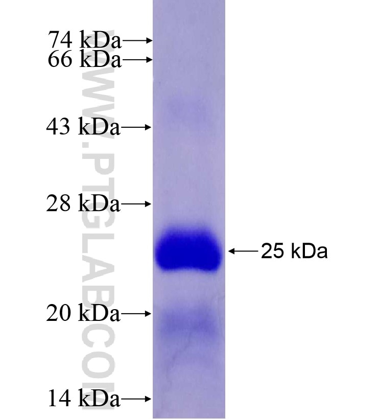 RARRES2 fusion protein Ag16701 SDS-PAGE