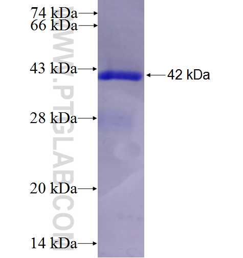 RARRES3 fusion protein Ag2702 SDS-PAGE