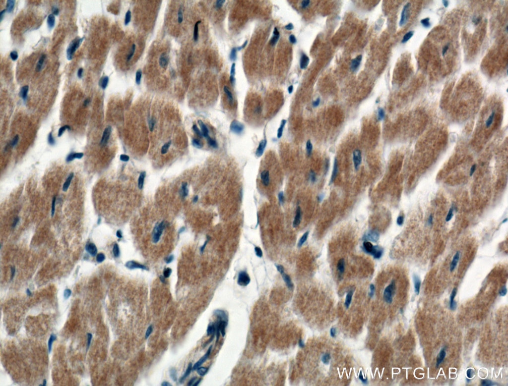 Immunohistochemistry (IHC) staining of human heart tissue using RARS Polyclonal antibody (27344-1-AP)