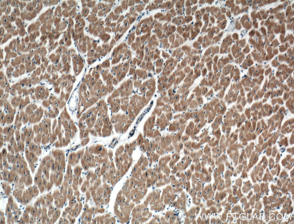IHC staining of human heart using 27344-1-AP