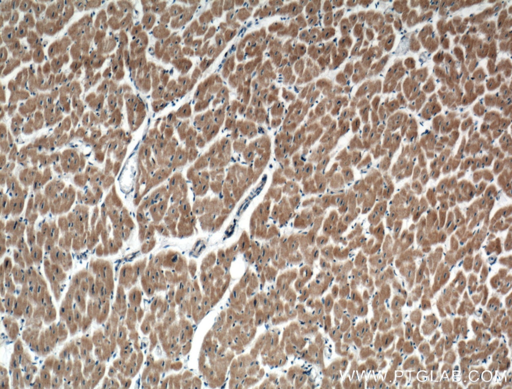 Immunohistochemistry (IHC) staining of human heart tissue using RARS Polyclonal antibody (27344-1-AP)