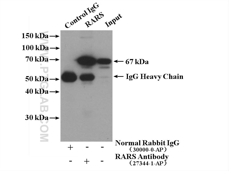 Immunoprecipitation (IP) experiment of HeLa cells using RARS Polyclonal antibody (27344-1-AP)
