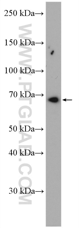 Western Blot (WB) analysis of A431 cells using RARS Polyclonal antibody (27344-1-AP)