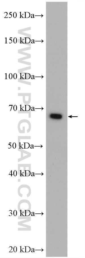 Western Blot (WB) analysis of HeLa cells using RARS Polyclonal antibody (27344-1-AP)