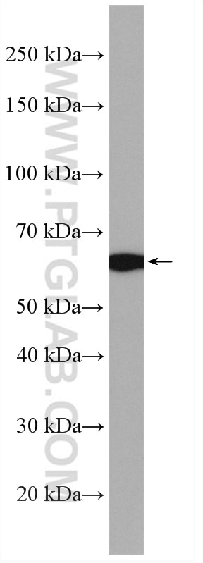 Western Blot (WB) analysis of U-251 cells using RARS Polyclonal antibody (27344-1-AP)