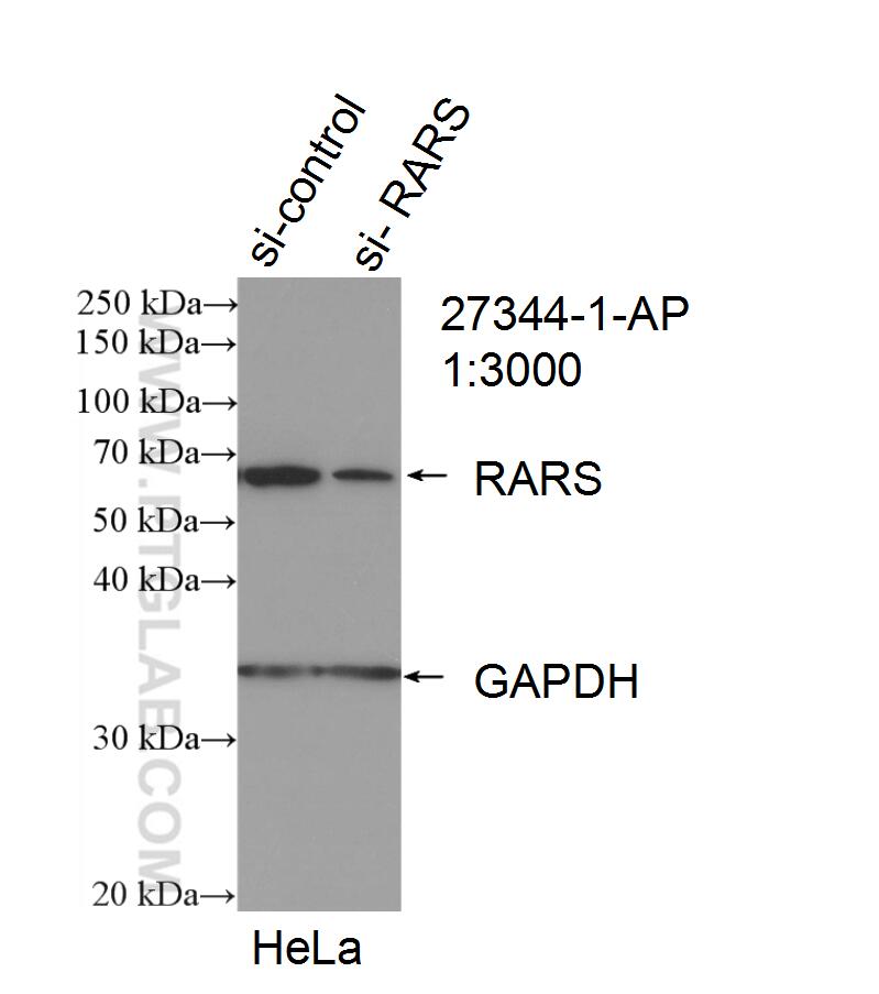 Western Blot (WB) analysis of HeLa cells using RARS Polyclonal antibody (27344-1-AP)