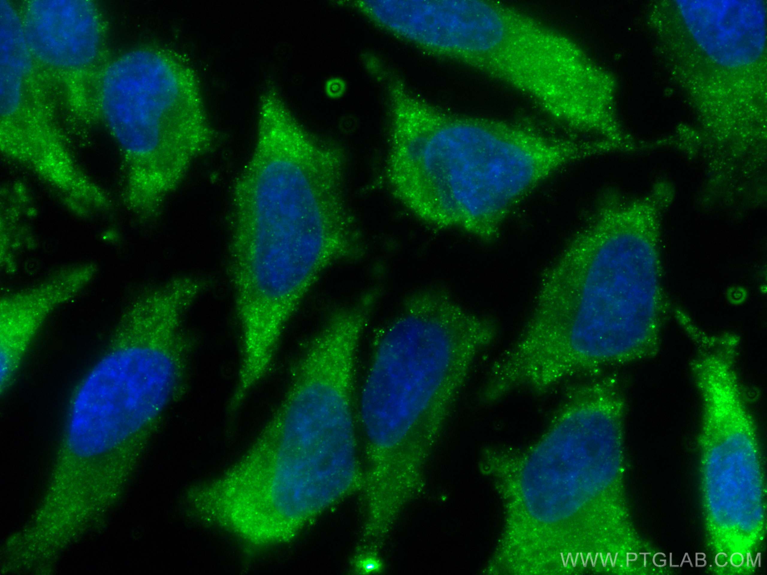Immunofluorescence (IF) / fluorescent staining of HeLa cells using RARS Monoclonal antibody (66815-1-Ig)