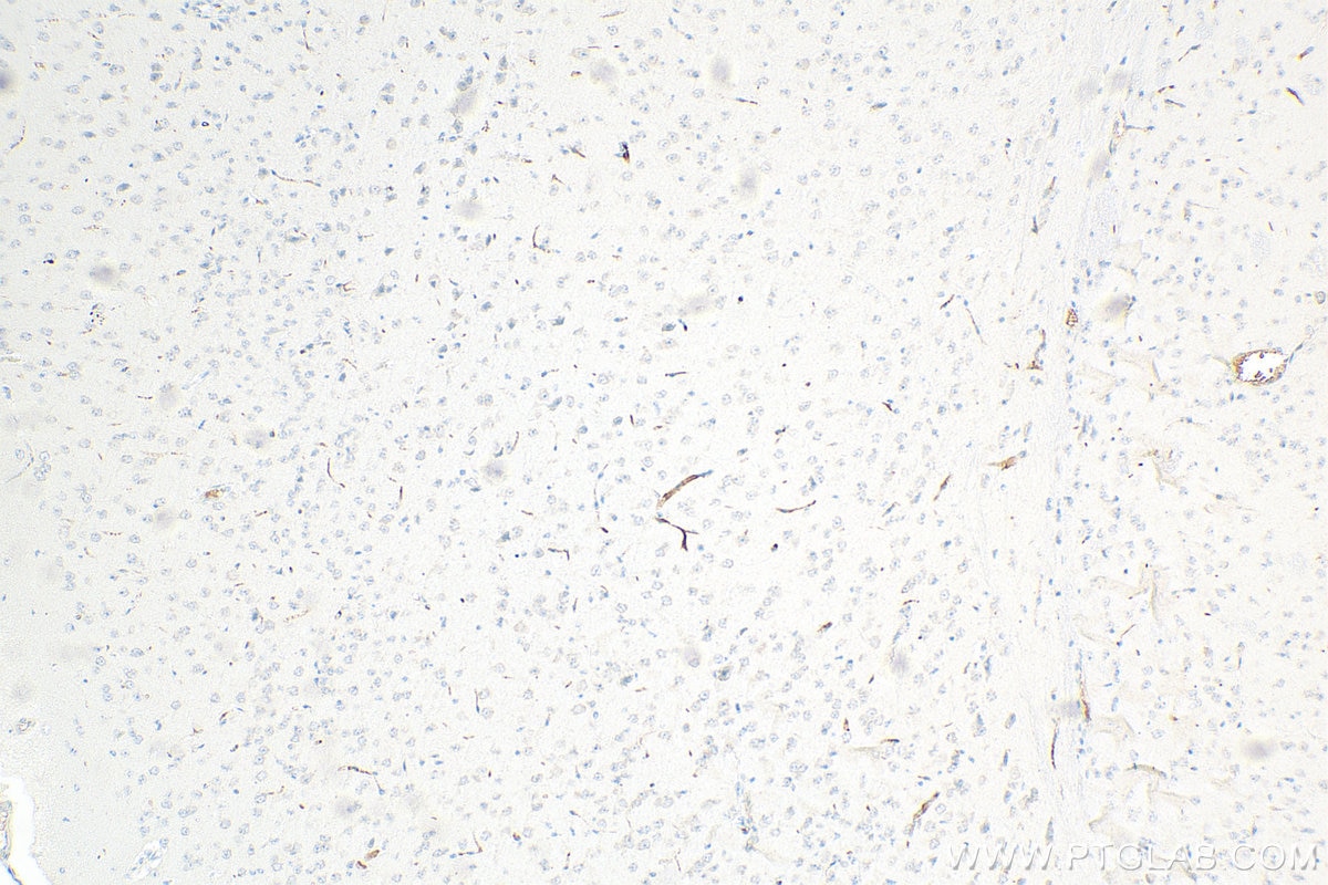 Immunohistochemistry (IHC) staining of mouse brain tissue using RARS Monoclonal antibody (66815-1-Ig)