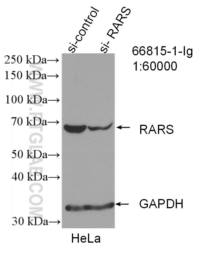 Western Blot (WB) analysis of HeLa cells using RARS Monoclonal antibody (66815-1-Ig)