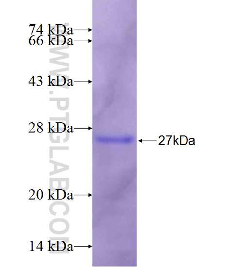 RARS fusion protein Ag26399 SDS-PAGE