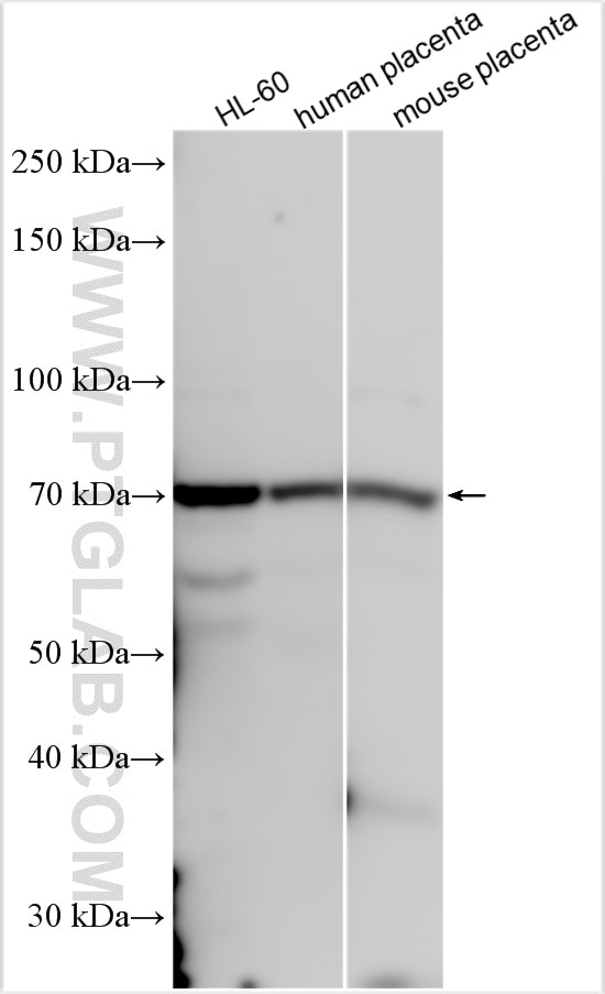 Western Blot (WB) analysis of various lysates using RARS2 Polyclonal antibody (16079-1-AP)