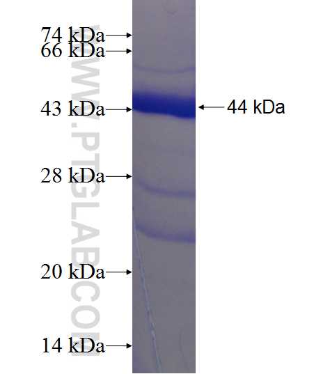 RARS2 fusion protein Ag9088 SDS-PAGE