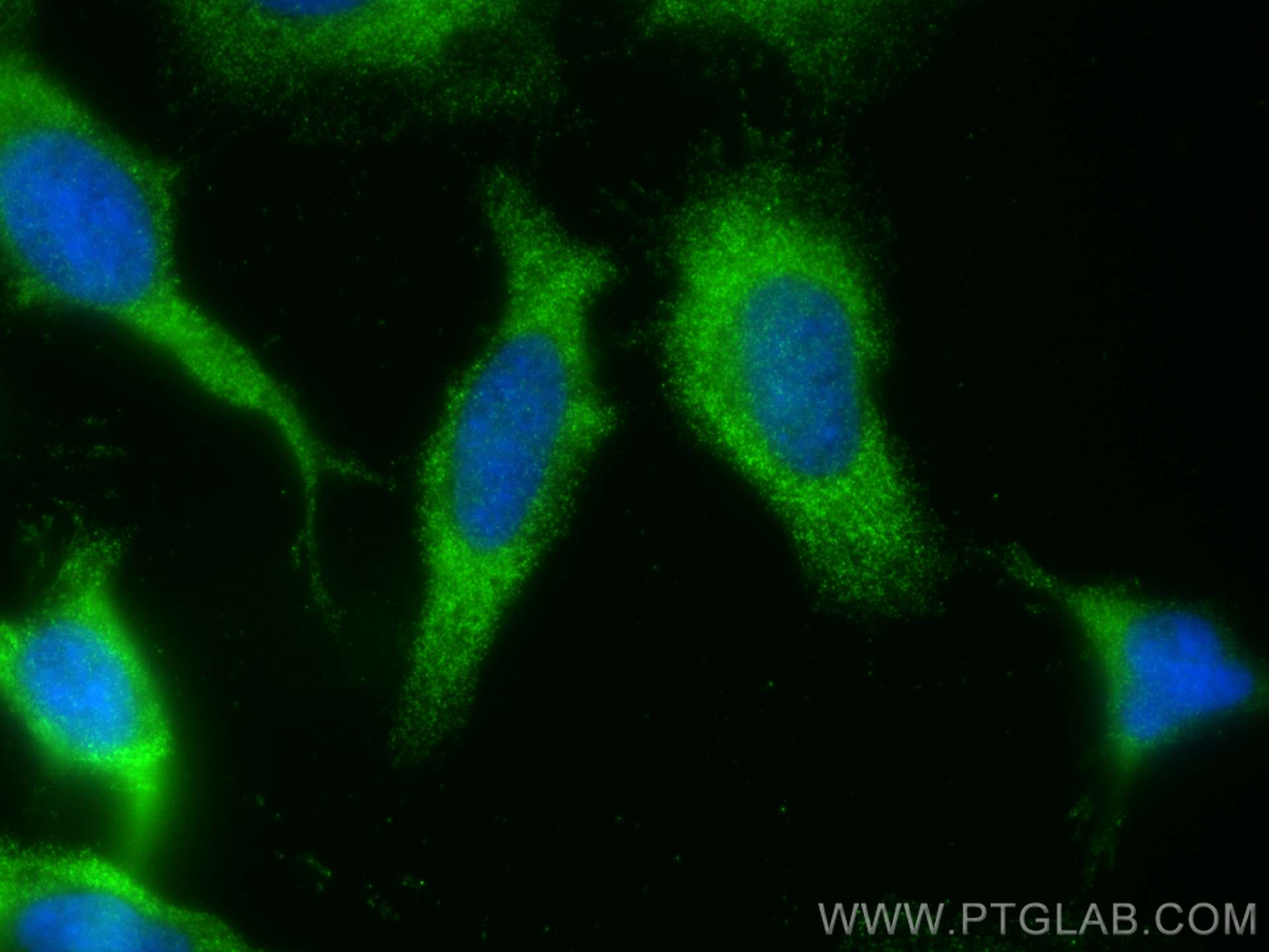 Immunofluorescence (IF) / fluorescent staining of HeLa cells using RASGAP Polyclonal antibody (12935-1-AP)