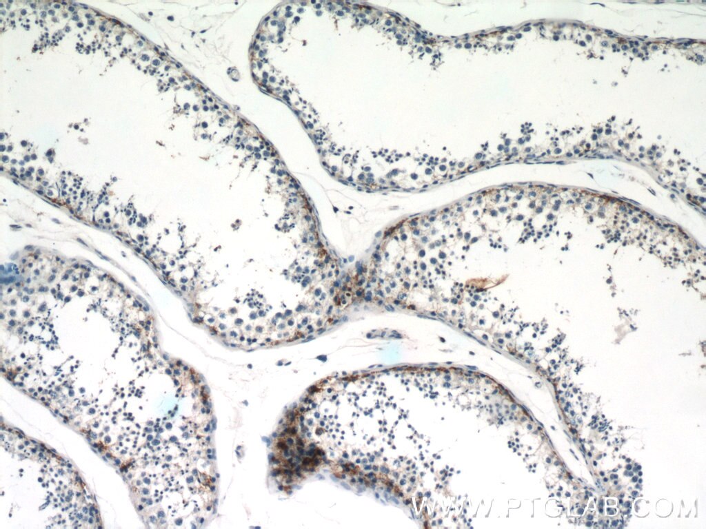 Immunohistochemistry (IHC) staining of human testis tissue using RASGAP Polyclonal antibody (12935-1-AP)