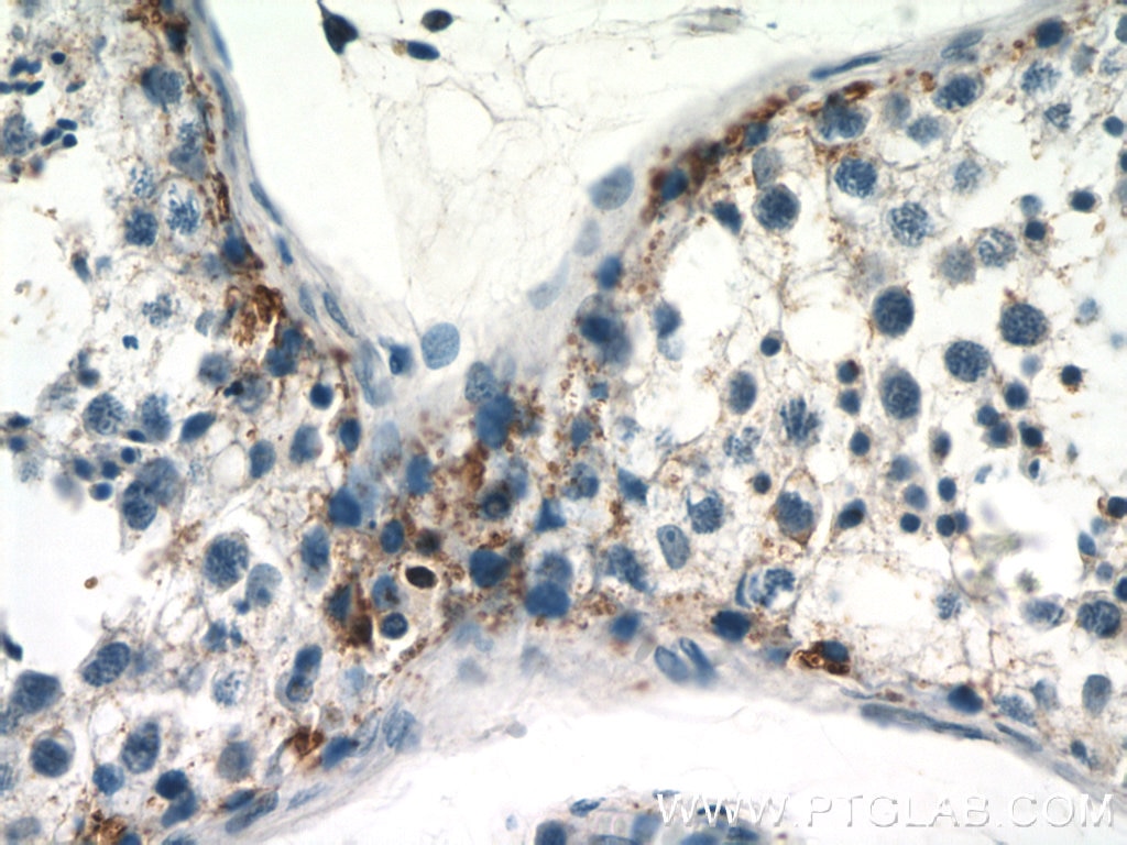 Immunohistochemistry (IHC) staining of human testis tissue using RASGAP Polyclonal antibody (12935-1-AP)