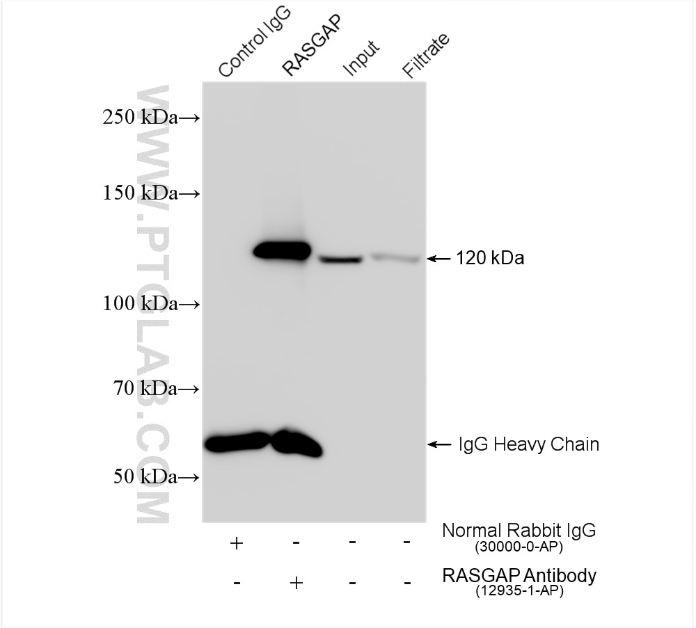 Immunoprecipitation (IP) experiment of mouse testis tissue using RASGAP Polyclonal antibody (12935-1-AP)