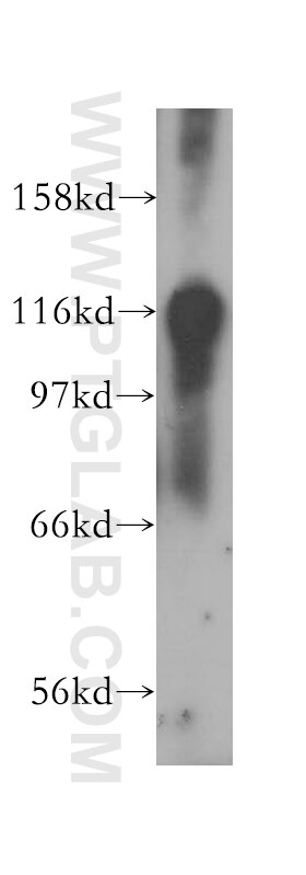 RASGAP Polyclonal antibody