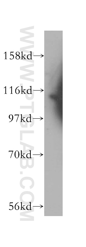 Western Blot (WB) analysis of mouse testis tissue using RASGAP Polyclonal antibody (12935-1-AP)
