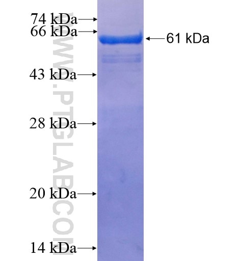 RASA1 fusion protein Ag3906 SDS-PAGE