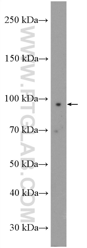 Western Blot (WB) analysis of HeLa cells using RASA2/3 Polyclonal antibody (27835-1-AP)