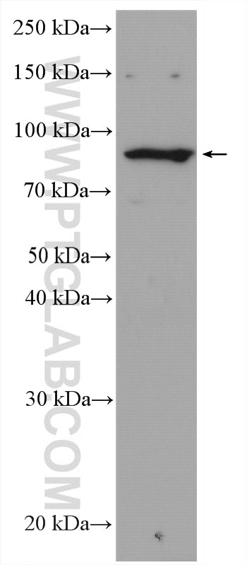 Western Blot (WB) analysis of 3T3-L1 cells using RASA2/3 Polyclonal antibody (27835-1-AP)