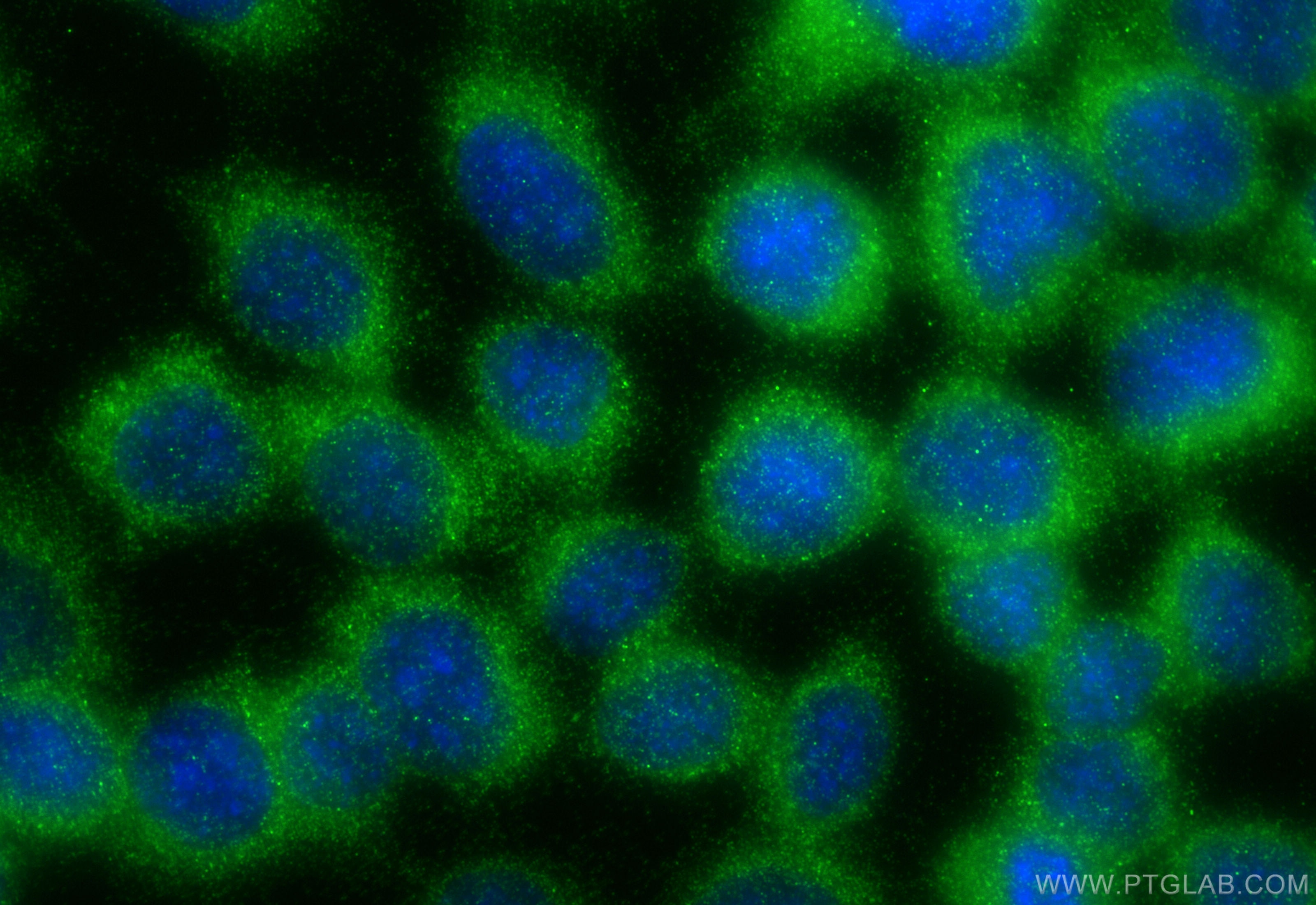 IF Staining of A431 using 31586-1-AP Immunofluorescence (IF) / fluorescent staining of A431 cells using RASA2 Polyclonal antibody (31586-1-AP)