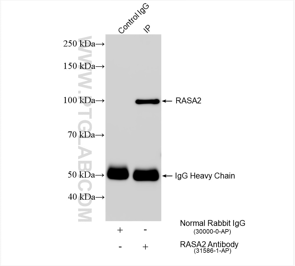 IP experiment of Jurkat using 31586-1-AP Immunoprecipitation (IP) experiment of Jurkat cells using RASA2 Polyclonal antibody (31586-1-AP)