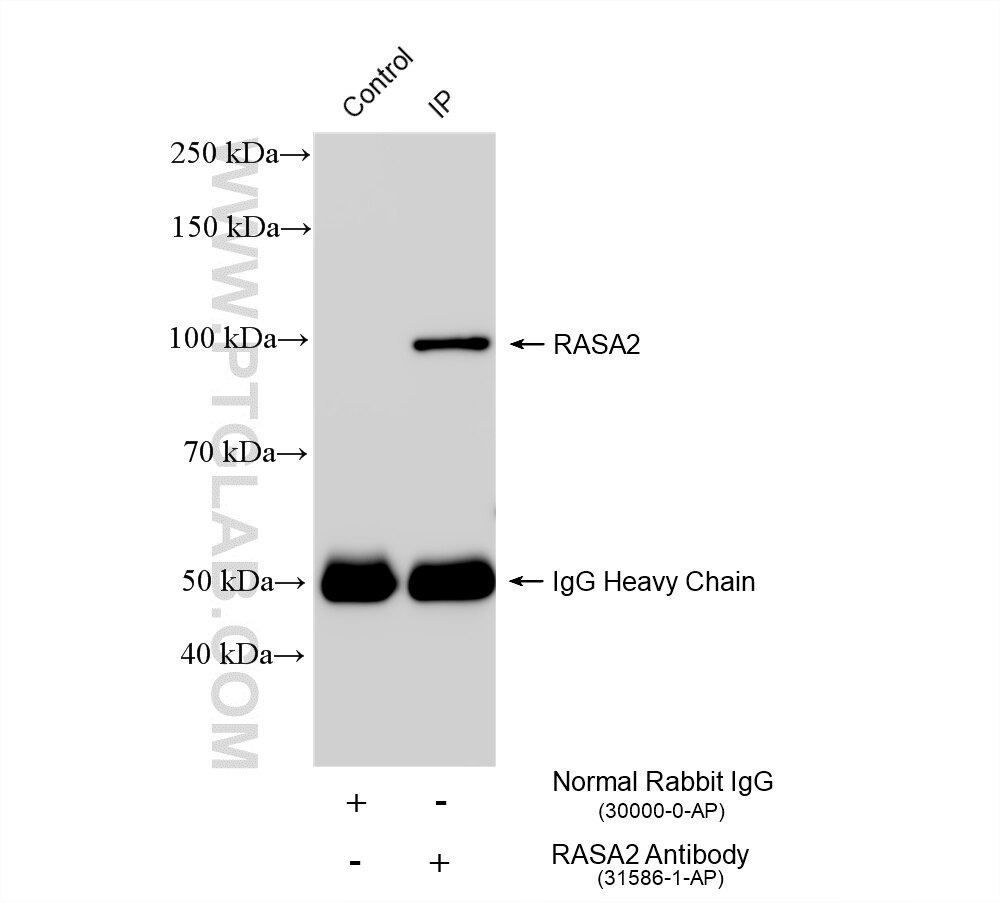 IP experiment of A431 using 31586-1-AP Immunoprecipitation (IP) experiment of A431 cells using RASA2 Polyclonal antibody (31586-1-AP)