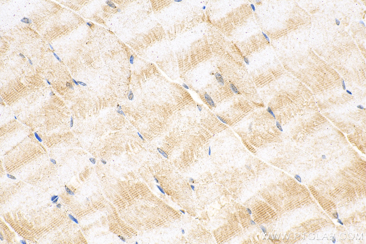 Immunohistochemistry (IHC) staining of mouse skeletal muscle tissue using RASA4B Polyclonal antibody (31288-1-AP)