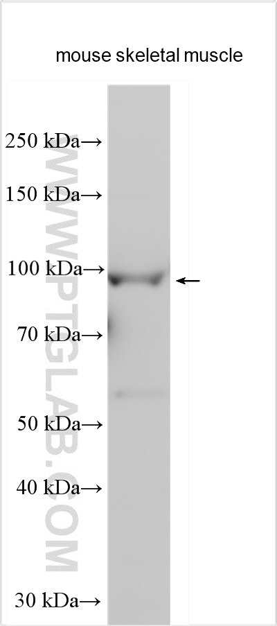 Western Blot (WB) analysis of various lysates using RASA4B Polyclonal antibody (31288-1-AP)
