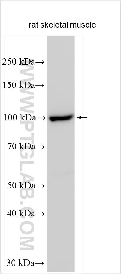Western Blot (WB) analysis of various lysates using RASA4B Polyclonal antibody (31288-1-AP)