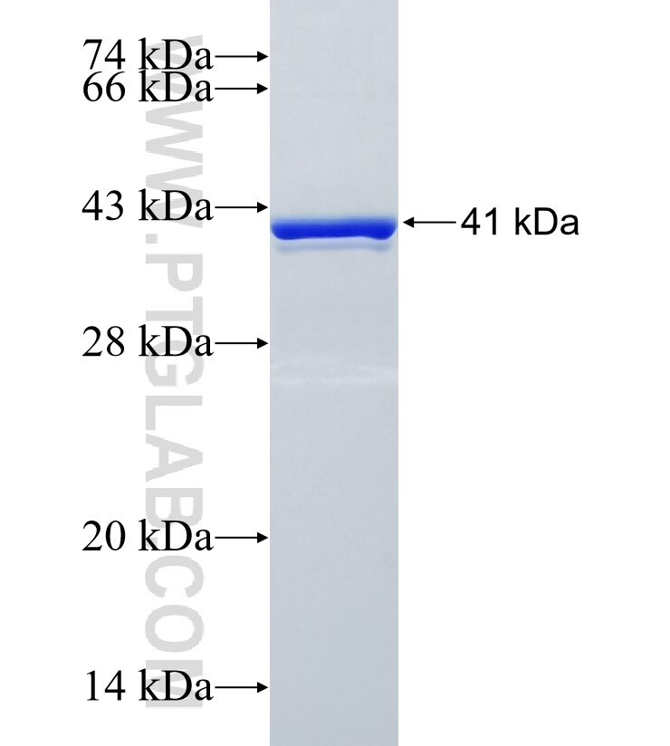 RASA4B fusion protein Ag35038 SDS-PAGE