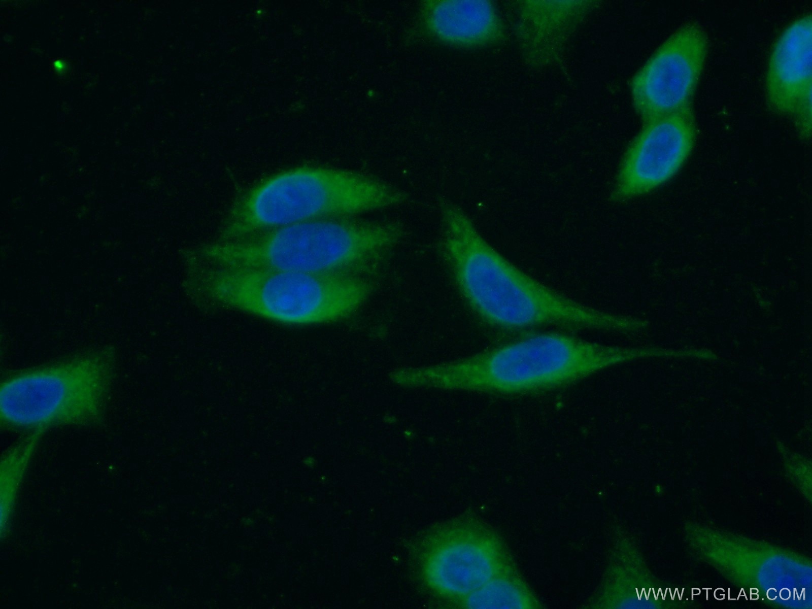 Immunofluorescence (IF) / fluorescent staining of HeLa cells using RASAL2 Polyclonal antibody (22140-1-AP)