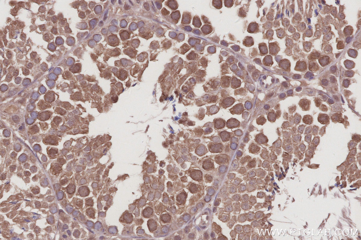 Immunohistochemistry (IHC) staining of mouse testis tissue using RASAL2 Polyclonal antibody (22140-1-AP)