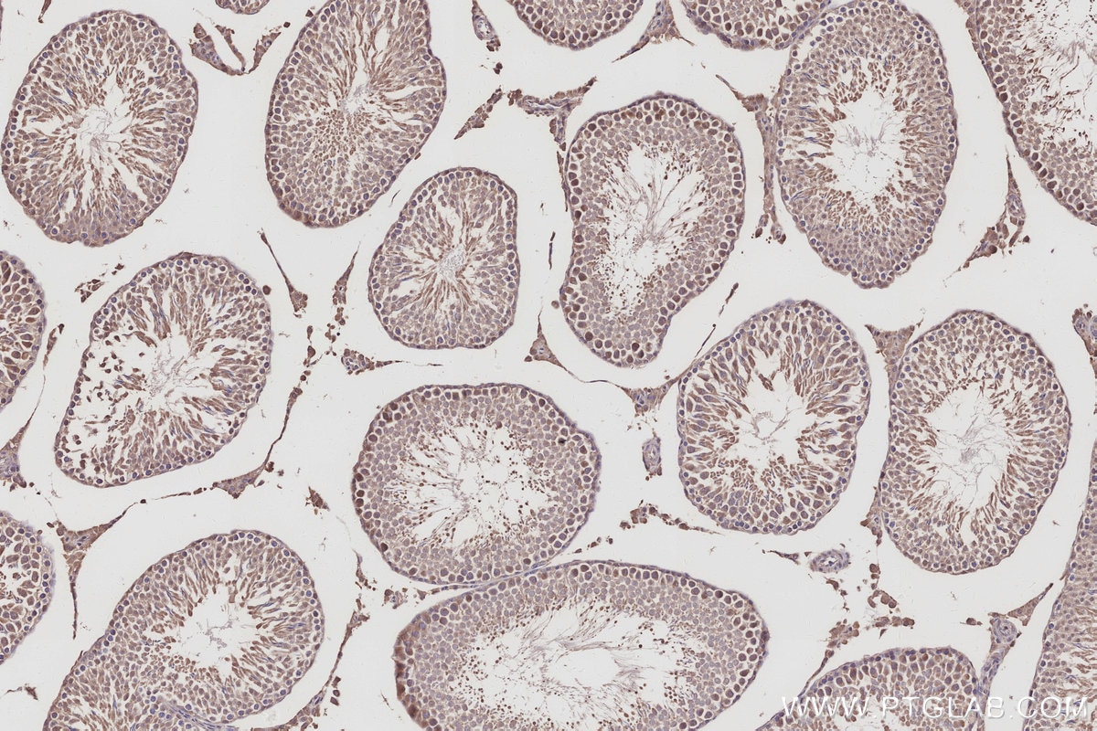 Immunohistochemistry (IHC) staining of rat testis tissue using RASAL2 Polyclonal antibody (22140-1-AP)