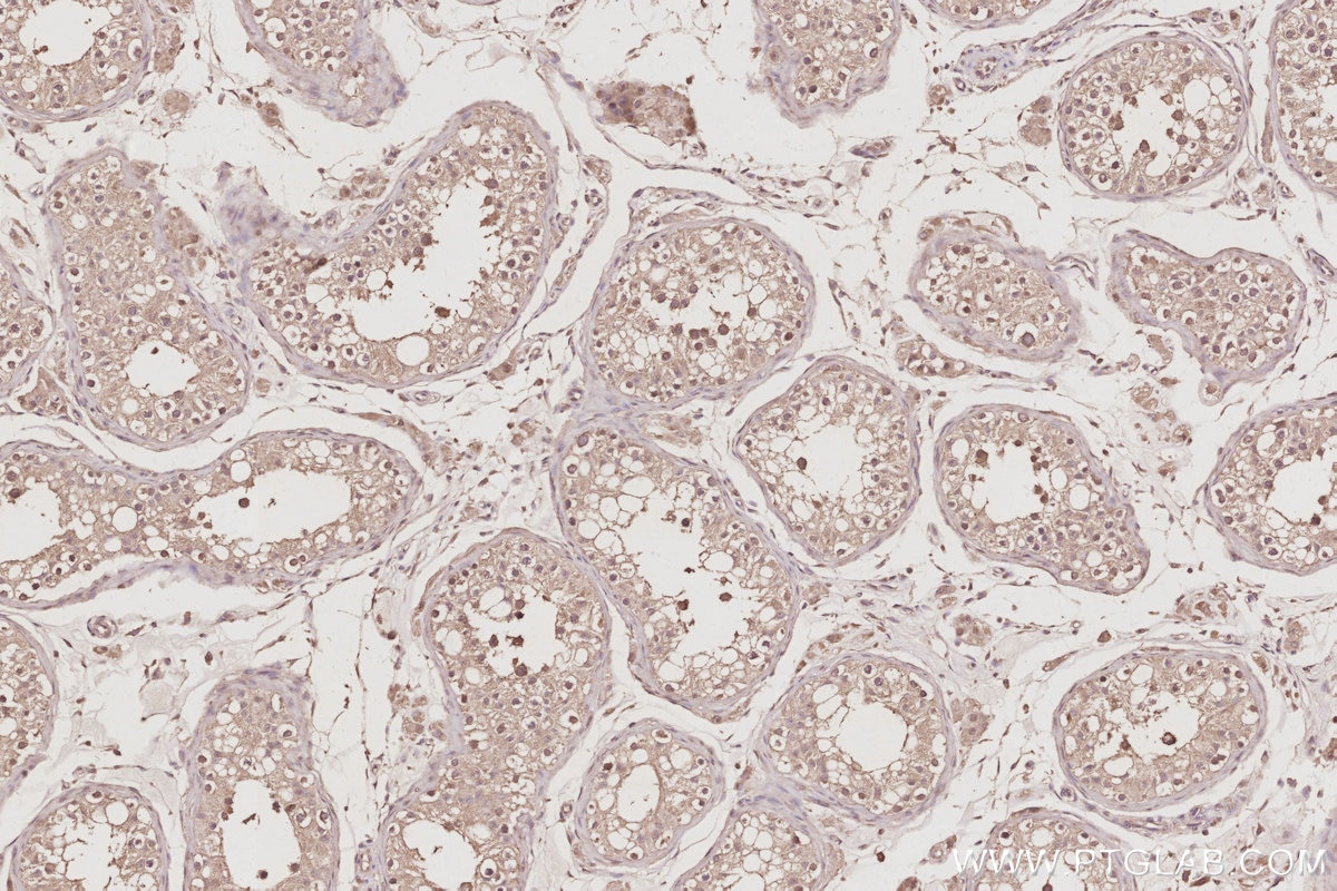 Immunohistochemistry (IHC) staining of human testis tissue using RASAL2 Polyclonal antibody (22140-1-AP)