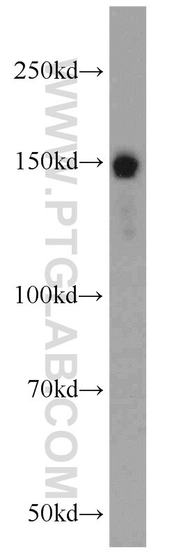 Western Blot (WB) analysis of HeLa cells using RASAL2 Polyclonal antibody (22140-1-AP)