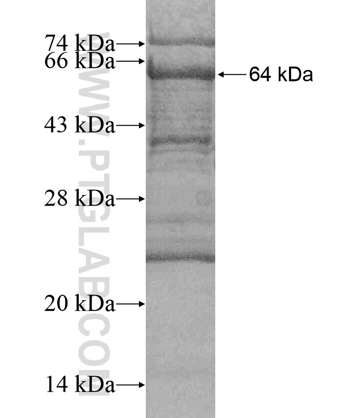 RASAL2 fusion protein Ag17555 SDS-PAGE