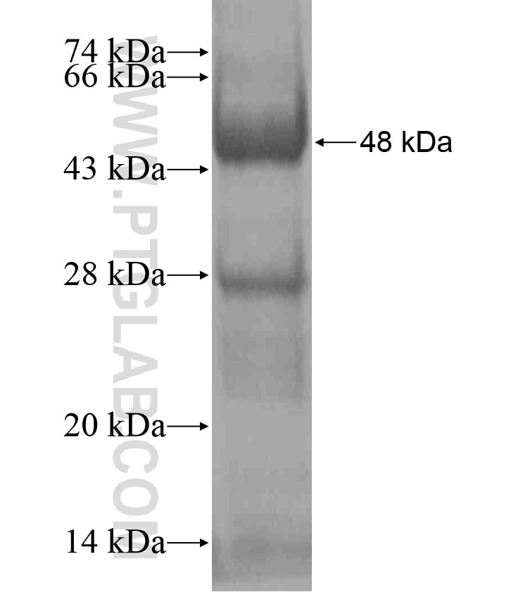 RASAL2 fusion protein Ag17975 SDS-PAGE