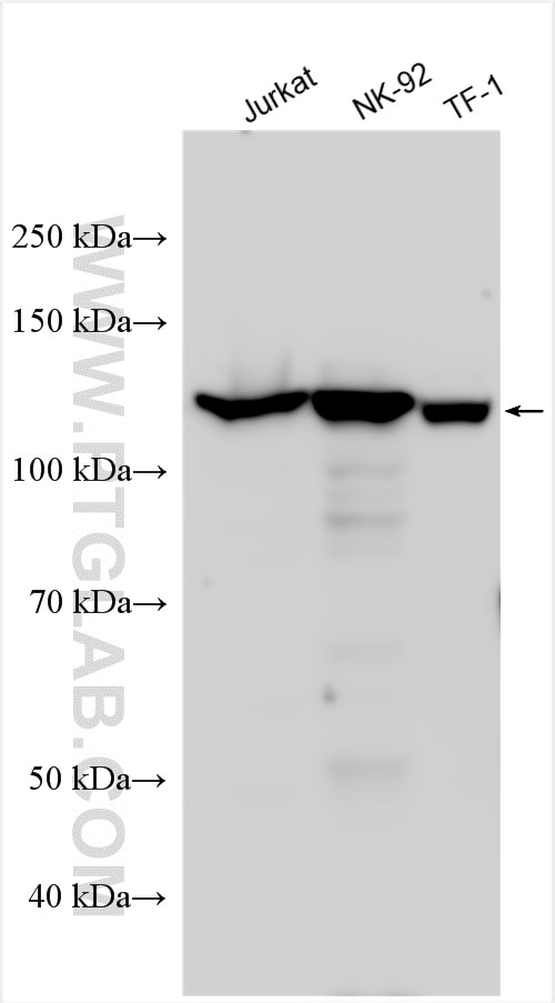 Western Blot (WB) analysis of various lysates using RASAL3 Polyclonal antibody (21164-1-AP)