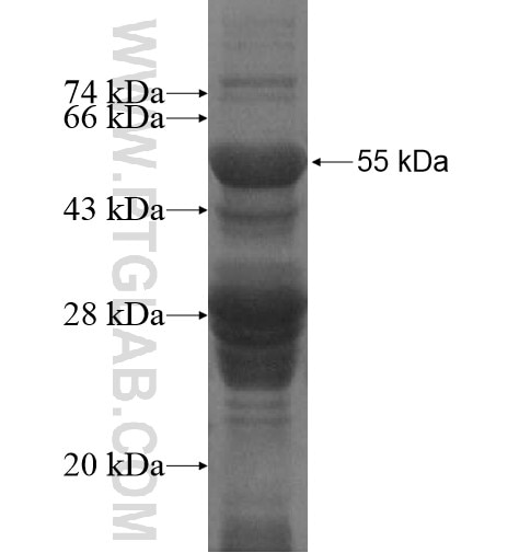 RASAL3 fusion protein Ag15189 SDS-PAGE